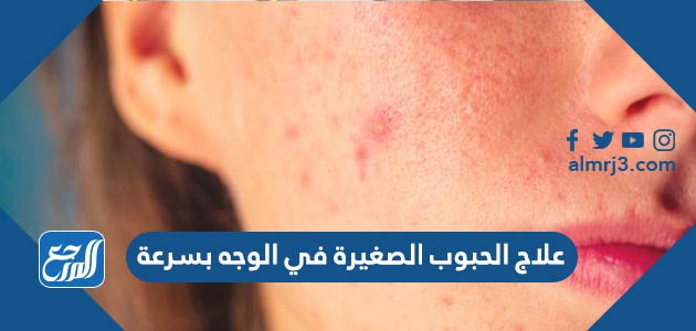 علاج الحبوب الصغيرة في الوجه بسرعة