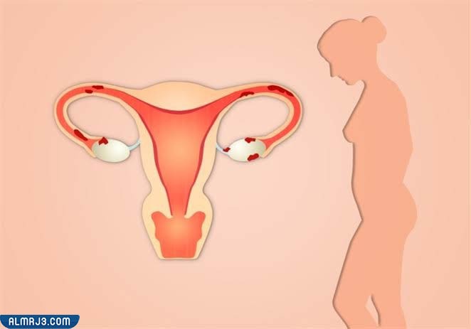 كيف أعرف أيام التبويض انتهت؟