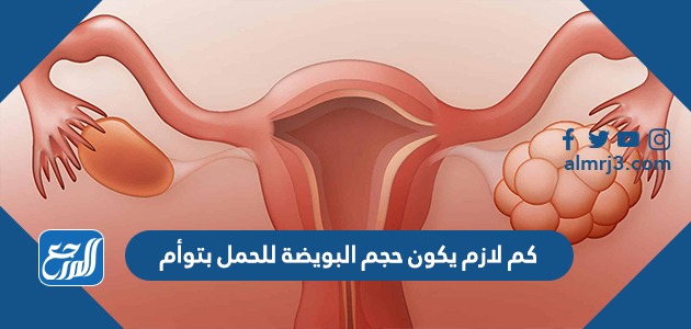 كم لازم يكون حجم البويضة للحمل بتوأم