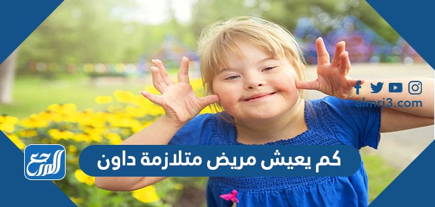 كم يعيش مريض متلازمة داون