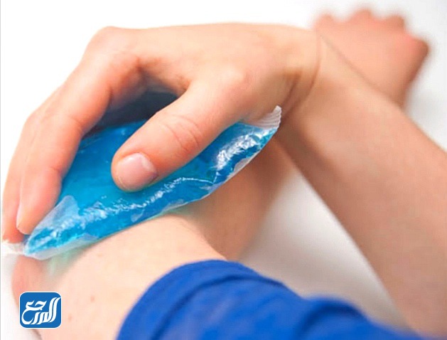 كيفية علاج الكدمات