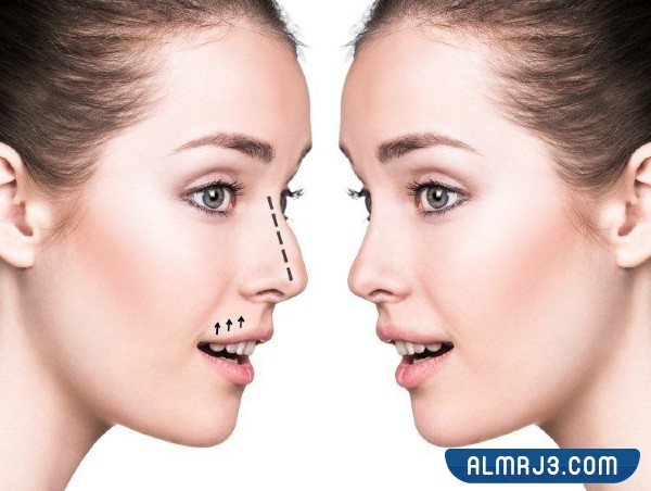 لماذا إجراء عملية تجميل الأنف بالخيوط في دبي أفضل