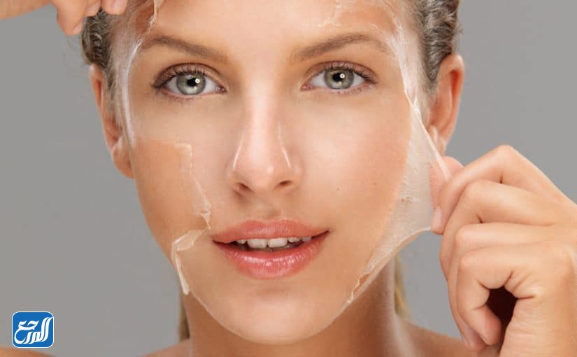 ما هو التقشير البارد