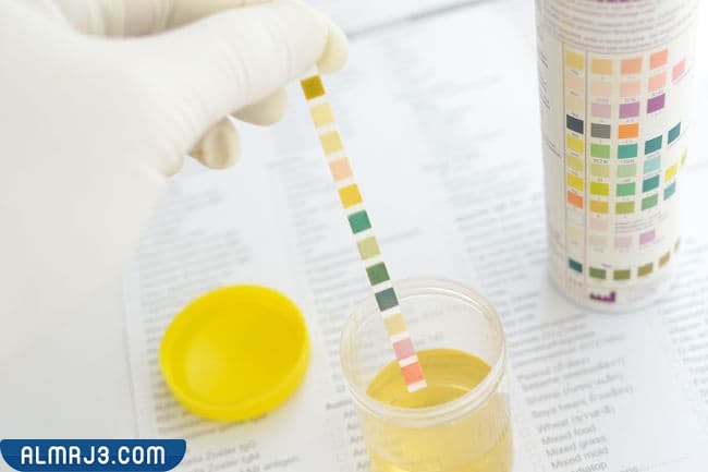 ما هو زلال البول