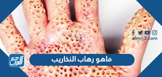 ماهو رهاب النخاريب