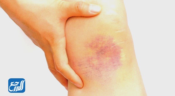 متى يجب عليك استشارة الطبيب