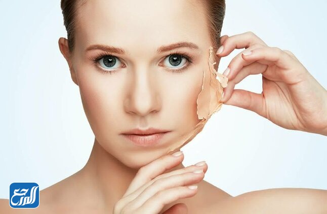 مراحل التقشير البارد