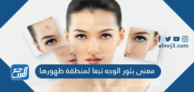معنى بثور الوجه تبعا لمنطقة ظهورها