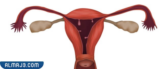 نصائح للوقاية من نزول الرحم