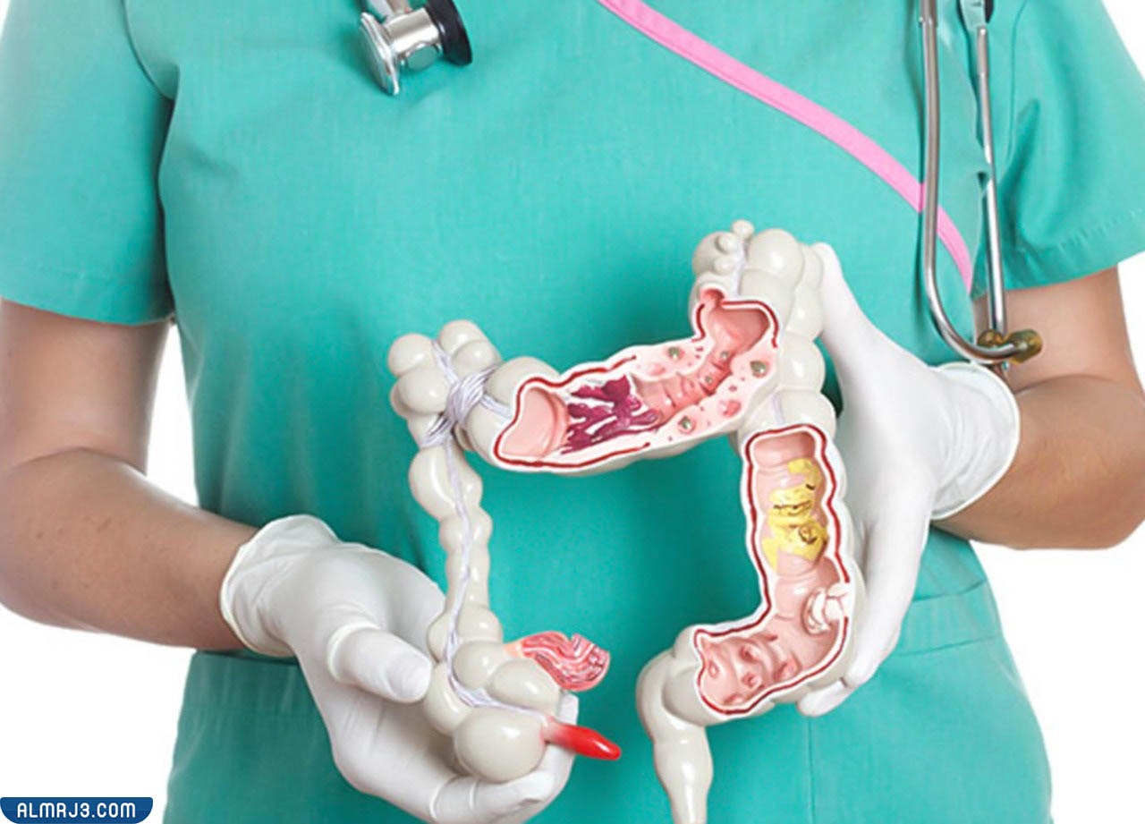 هل منظار القولون يحتاج إلى تخدير كامل