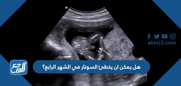 هل يمكن ان يخطئ السونار في الشهر الرابع؟