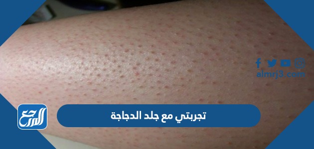 تجربتي مع جلد الدجاجة