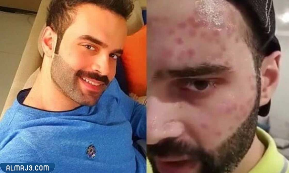 تفاصيل تعرض سعود بوشهري للحسد وتشوه الوجه