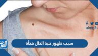 سبب ظهور حبة الخال فجأة وما هي أنواعها