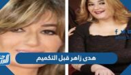 صور هدى زاهر قبل التكميم