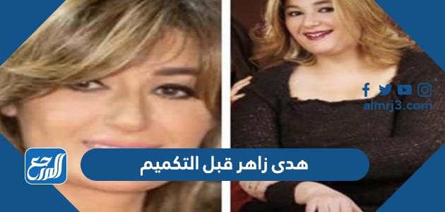 صور هدى زاهر قبل التكميم