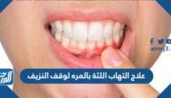 علاج التهاب اللثه بالمره لوقف النزيف