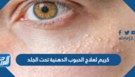 أفضل كريم لعلاج الحبوب الدهنية تحت الجلد في الصيدليات