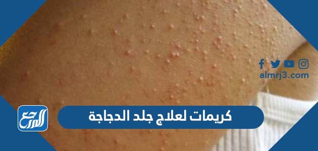 كريمات لعلاج جلد الدجاجة