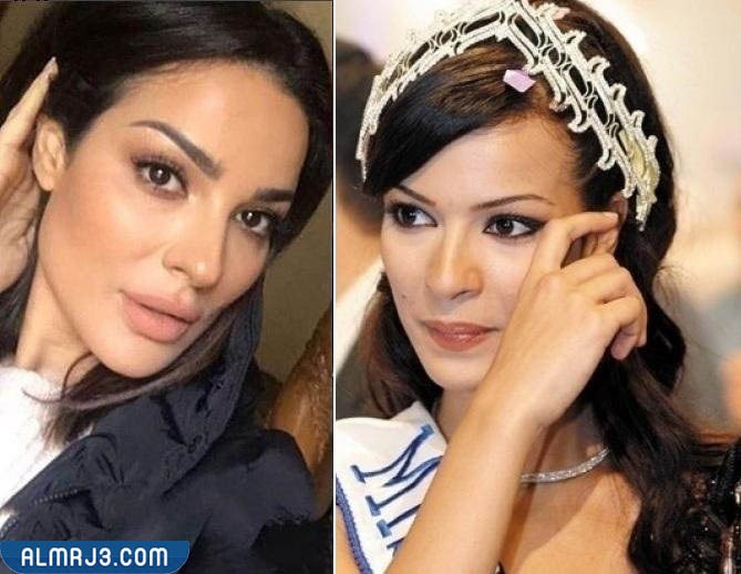 نادين نجيم قبل وبعد