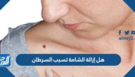 هل إزالة الشامة تسبب السرطان