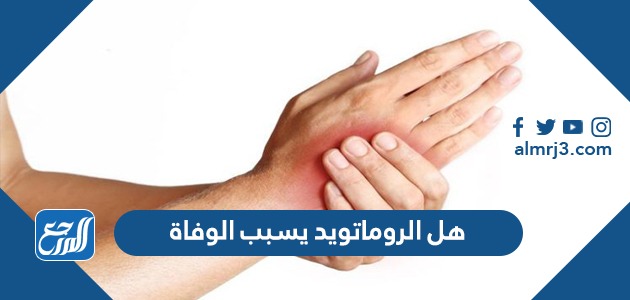 هل الروماتويد يسبب الوفاة