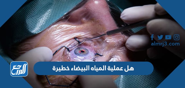 هل عملية المياه البيضاء خطيرة