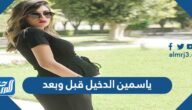 ياسمين الدخيل قبل وبعد