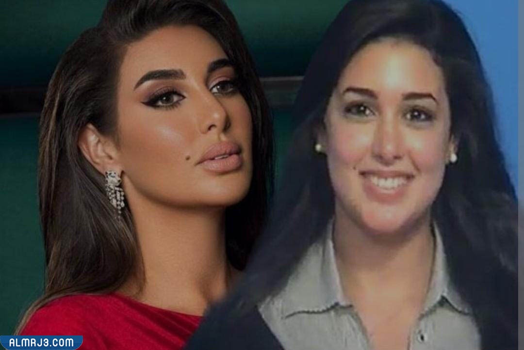 ياسمين صبري قبل وبعد