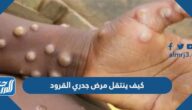 كيف ينتقل مرض جدري القرود