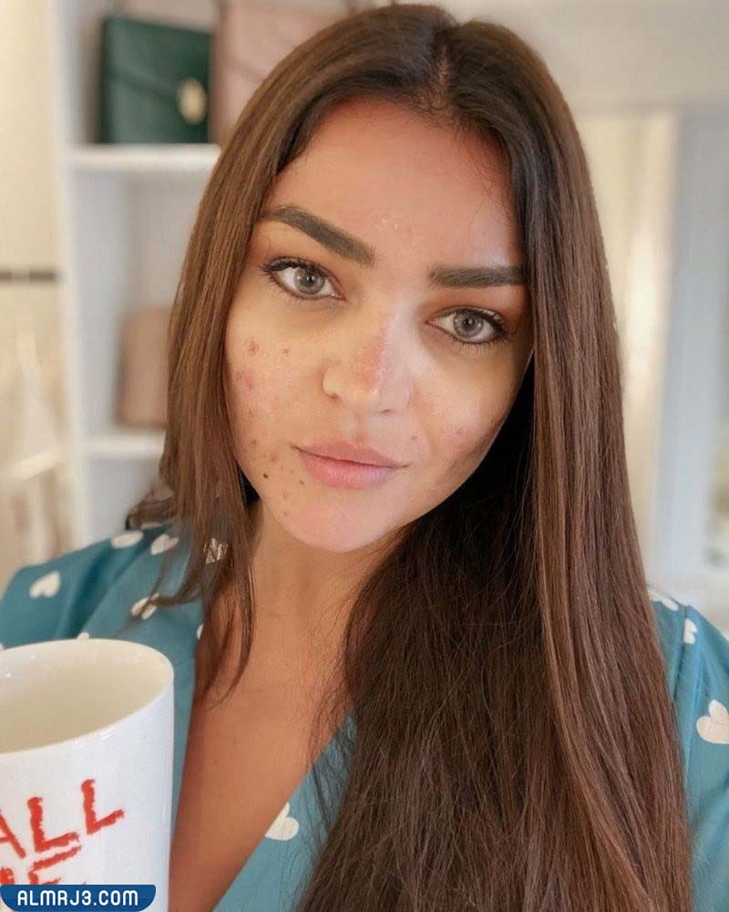 لين أبو شعر بدون مكياج