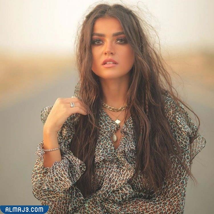 لين أبو شعر قبل عمليات التجميل