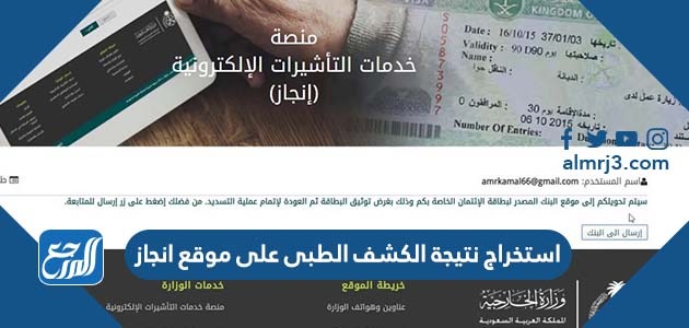 استخراج نتيجة الكشف الطبى على موقع انجاز