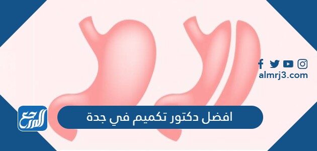 افضل دكتور تكميم في جدة مع تجارب المرضى والأسعار 2026