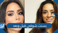 بسنت شوقي قبل وبعد