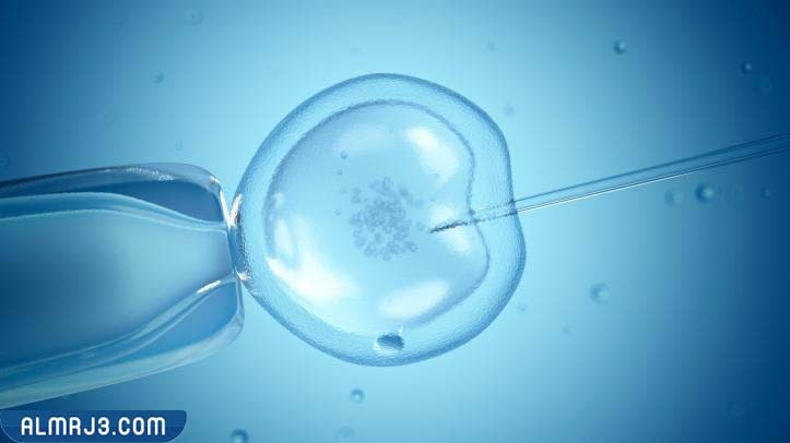 تجارب تحديد نوع الجنين بالحقن المجهري للحمل بولد