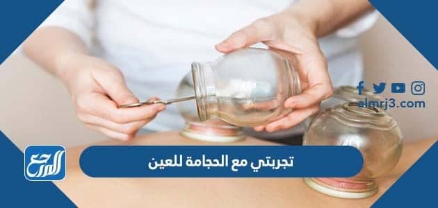 تجربتي مع الحجامة للعين