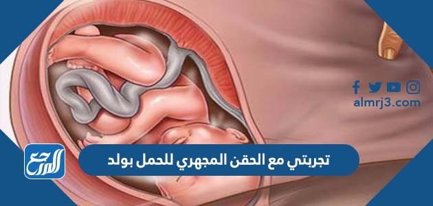 تجربتي مع الحقن المجهري للحمل بولد تجربتي مع الحقن المجهري للحمل بولد