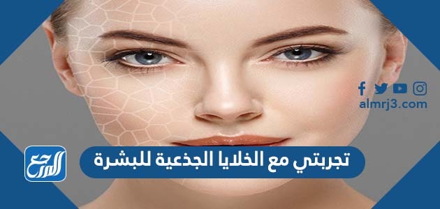 تجربتي مع الخلايا الجذعية للبشرة