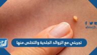 تجربتي مع الزوائد الجلدية والتخلص منها
