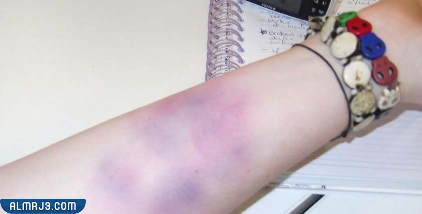 حالات تحتاج إلى مراجعة الطبيب