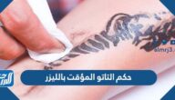 حكم التاتو المؤقت بالليزر