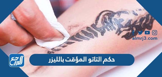حكم التاتو المؤقت بالليزر