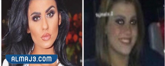 دكتورة يومي قبل التجميل
