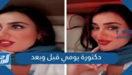 دكتورة يومي قبل وبعد