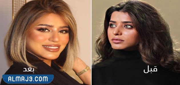 صمود الكندري قبل وبعد