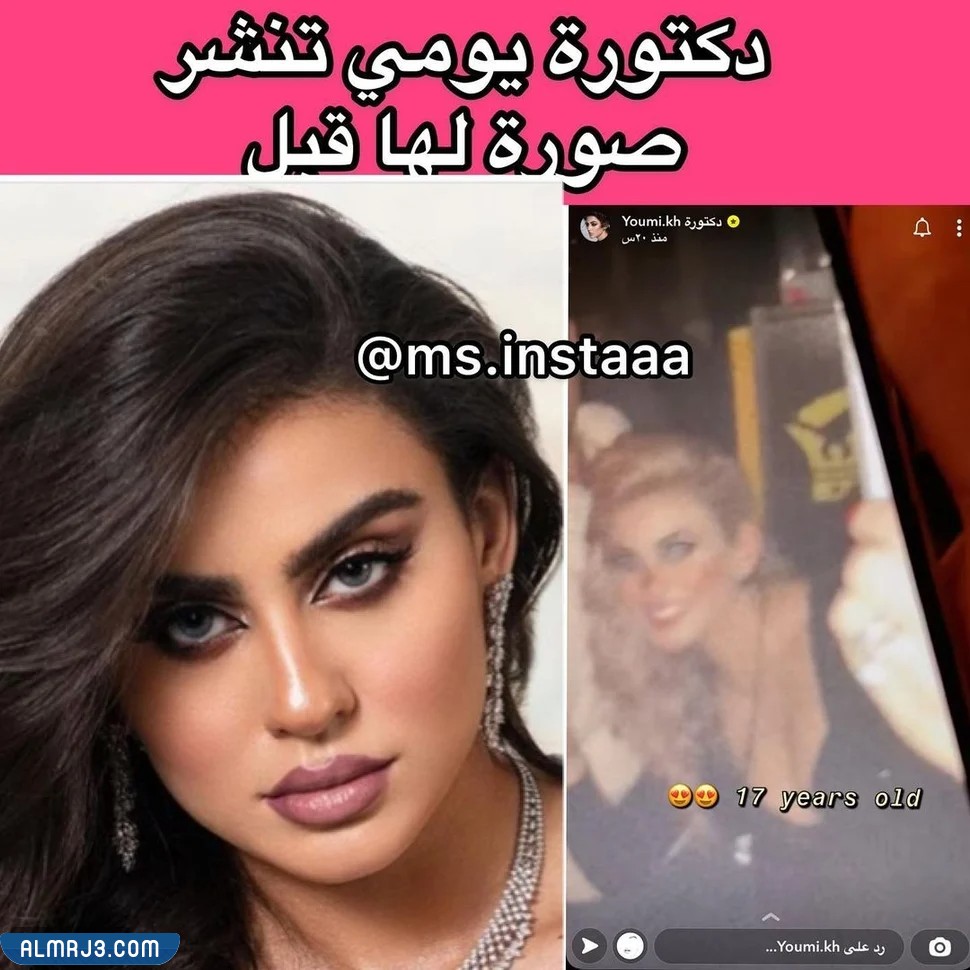 صور الدكتورة يومي قبل التجميل