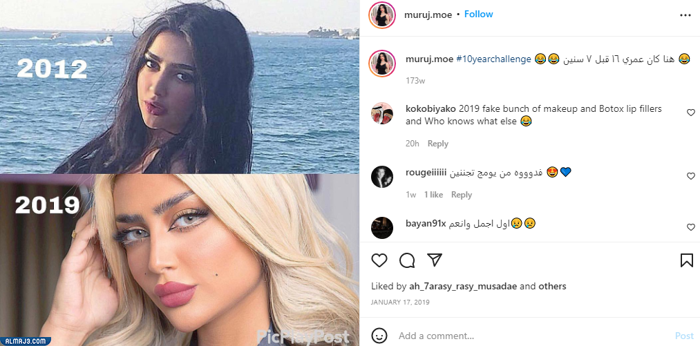 صور مروج الرحيلي قبل التجميل