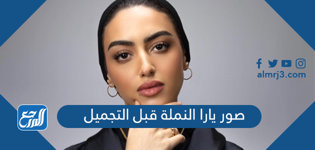 صور يارا النملة قبل التجميل