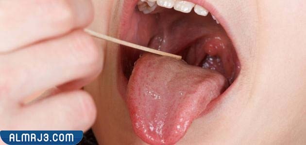 طرق تشخيص الاحتقان والمفرازات الأنفية